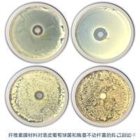 材料类抑菌实验