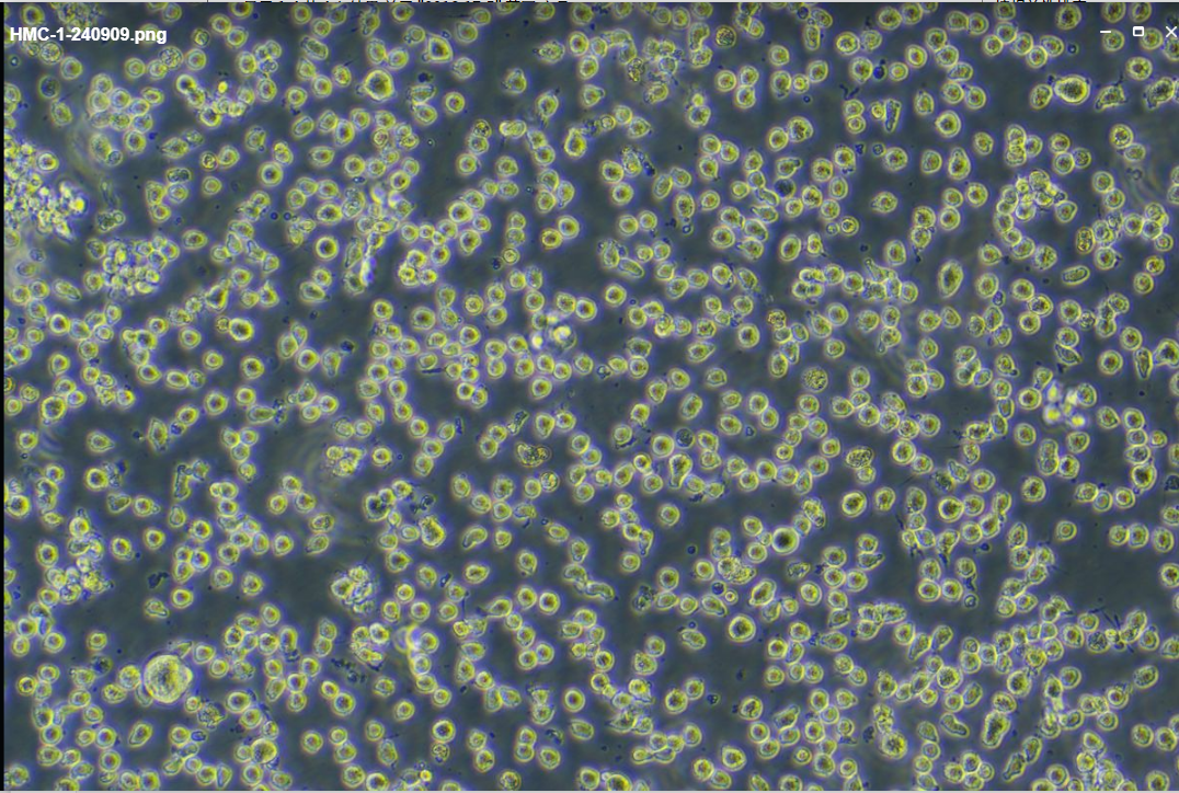 Detroit562人口腔咽头癌胸水转移细胞价格