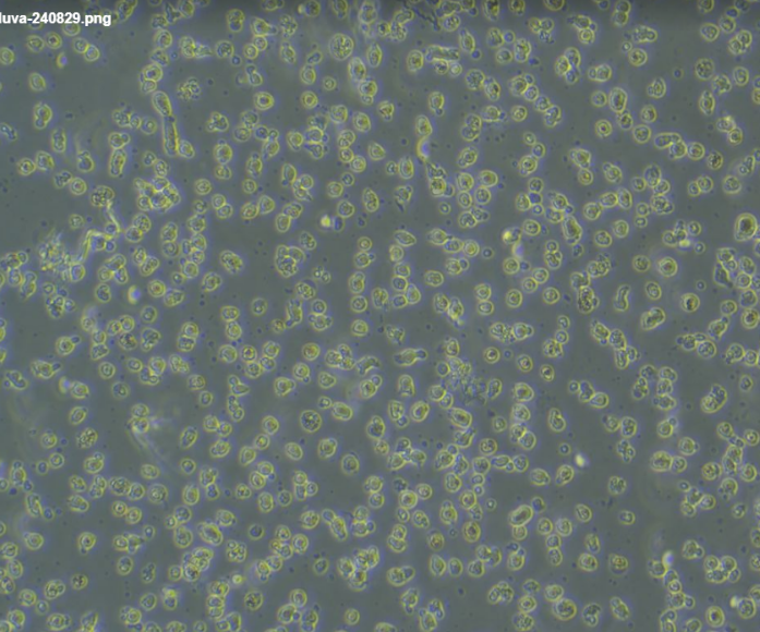 Detroit562人口腔咽头癌胸水转移细胞价格