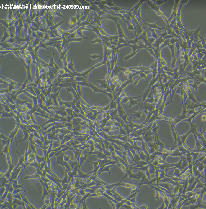 小鼠肝实质细胞AML12/GFP(带绿色荧光)