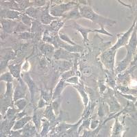 人主动脉外膜成纤维细胞系、永生化人主动脉外膜成纤维细胞