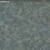 人非小细胞肺癌细胞NCI-H239/GFP(带绿色荧光)