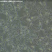 Wis-2/RFP (带绿色荧光)