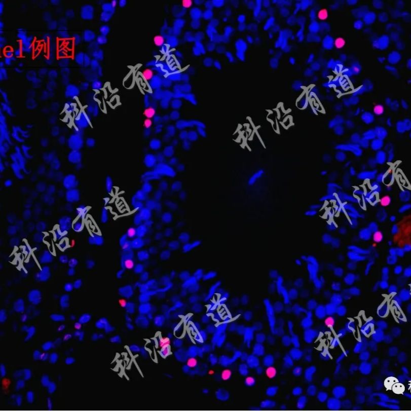 常见病理学检测