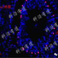 常见病理学检测