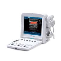 理邦EDAN 便携式全数字彩色超声诊断系统 U50