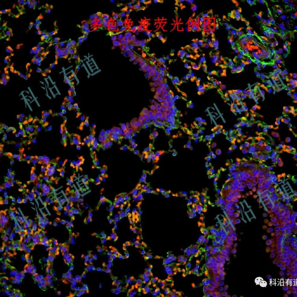 多重免疫荧光（TSA）服务