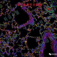 多重免疫荧光（TSA）服务