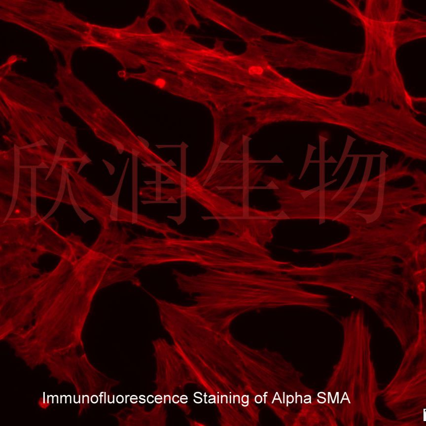 人膀胱平滑肌细胞系、永生化人膀胱平滑肌细胞