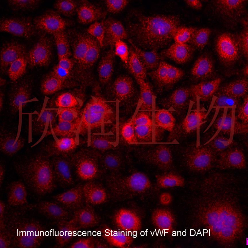小鼠肺微血管内皮细胞系、永生化小鼠肺微血管内皮细胞、小鼠肺血管内皮细胞系