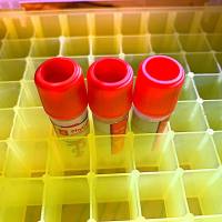 乙酰异戊酰泰乐菌素单克隆抗体  