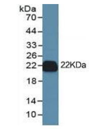 antibodies-online-IL-1 beta ELISA Kit促销 antibodies-online-IL-1 beta ELISA Kit促销