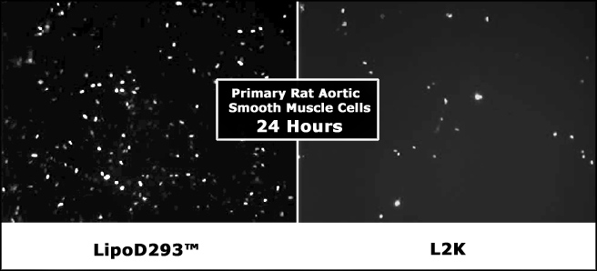 LipoD293™体外DNA转染试剂升级版