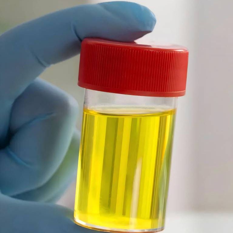 磁珠法大体积尿液游离核酸提取试剂盒