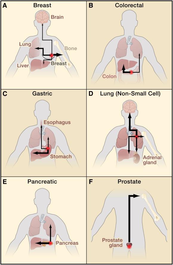 常用小鼠转移瘤模型，帮你整理好了！