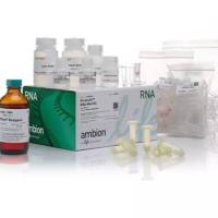 Quant-iT™ RiboGreen RNA 定量试剂盒与 RiboGreen RNA 试剂、RediPlate™ 96 RiboGreen™ RNA 定量试剂盒，R11490-1kit