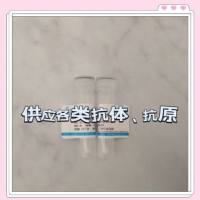 免疫球蛋白A(IgA)抗血清