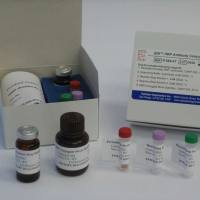 牛胰岛素样生长因子结合蛋白1(IGFBP1)ELISA检测试剂盒