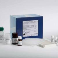 菠菜交替氧化酶(AOX)ELISA试剂盒