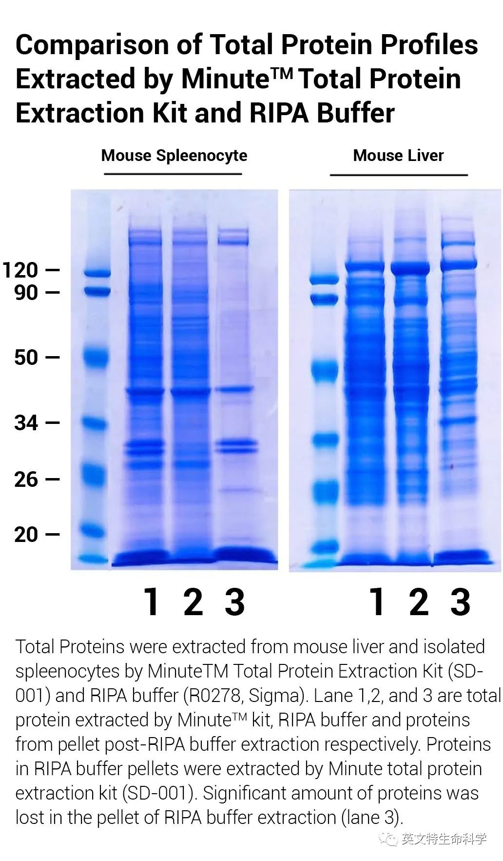 LC3条带总不出，为你支个招！