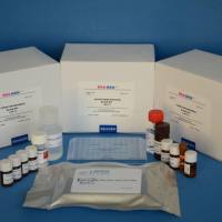 牛胰岛素样生长因子结合蛋白2(IGFBP2)ELISA检测试剂盒