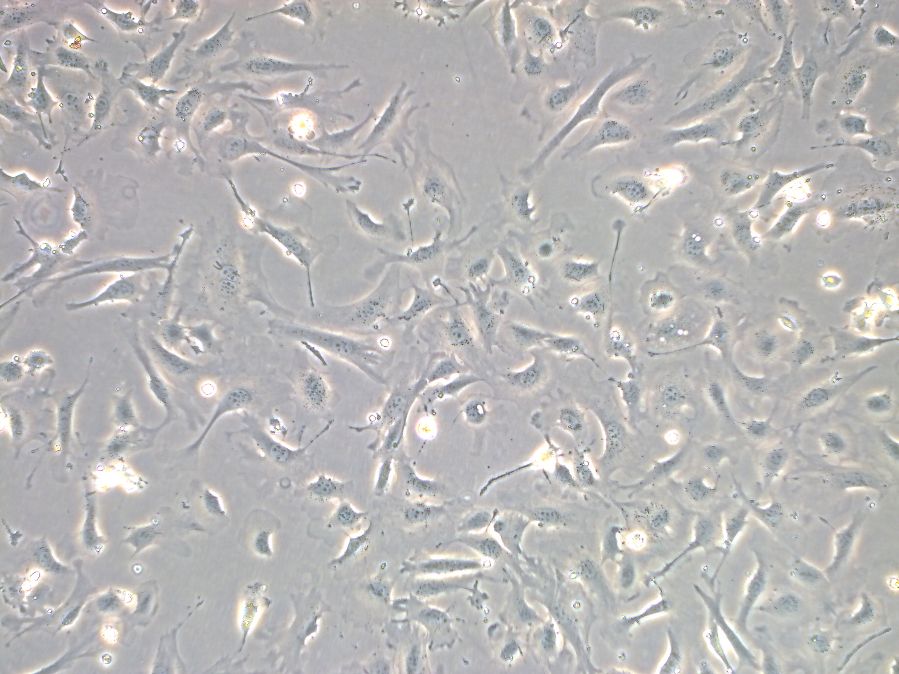 小鼠结肠成纤维细胞系专用完全培养基产品形态:成纤维细胞样传代能力