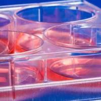 修饰蛋白质组学之乙酰化鉴定