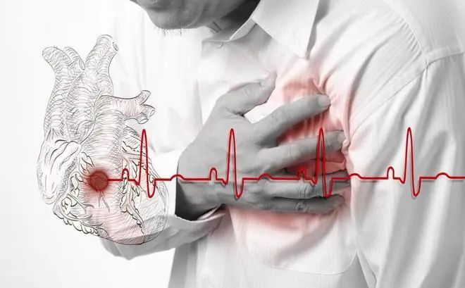 文献解读｜IF=10.7心梗患者的福音！国内团队发现抑制缺血再灌注损伤的新靶点