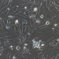 大鼠肾间质成纤维细胞/免疫荧光鉴定