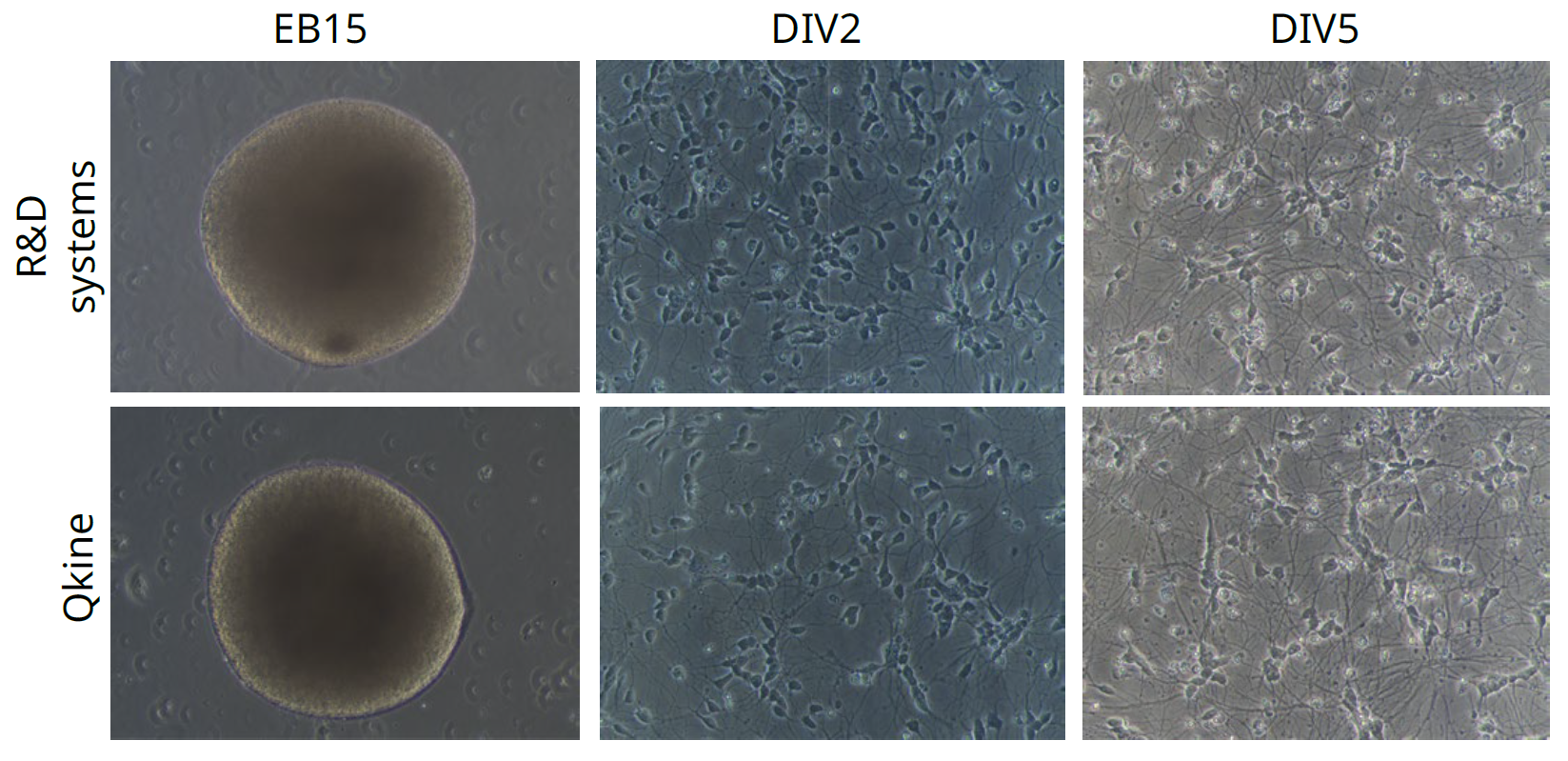 Qkine-运动神经元的形态和活力评估