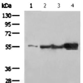 Vimentin mouse monoclonal antibody