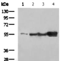 Vimentin mouse monoclonal antibody