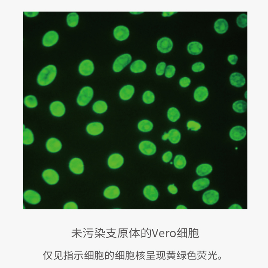 支原体“现形记”：培养、指示、PCR