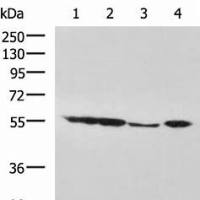AKT1 mouse monoclonal antibody