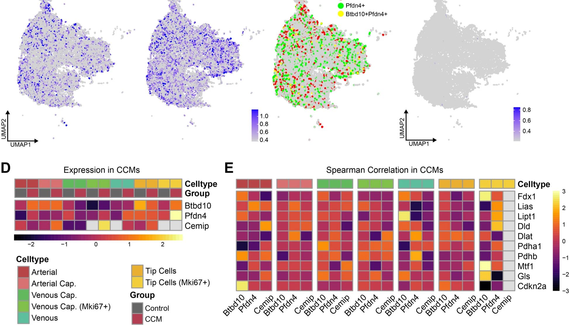 单细胞和Bulk-RNA测序揭示了与脑海绵状血管畸形中铜凋亡相关的免疫浸润景观