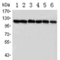 PARP mouse monoclonal antibody