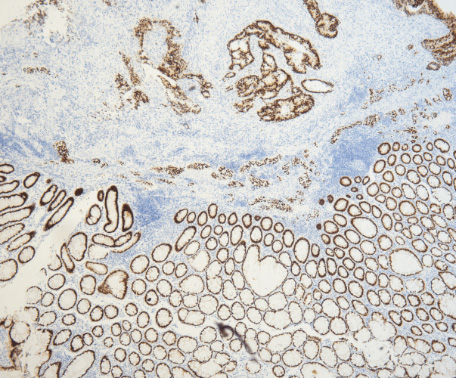 仅需12步，助你做出完美免疫组化IHC片子