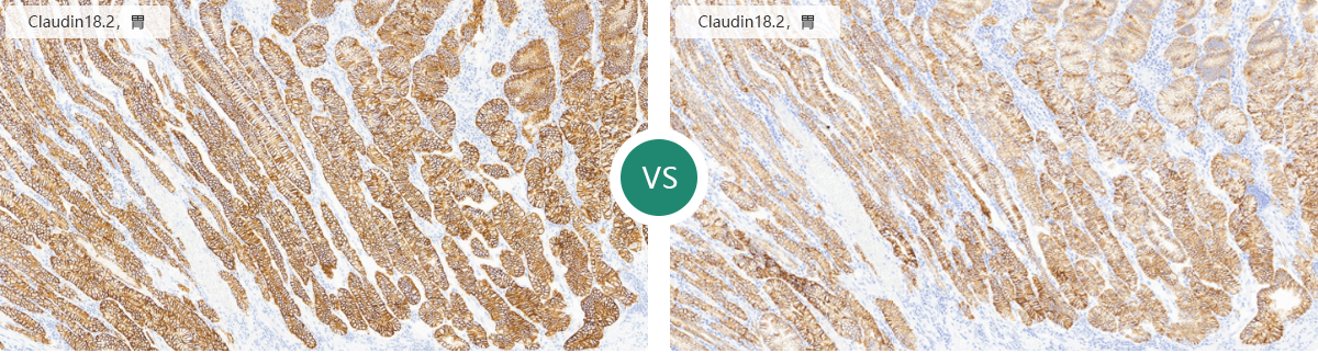 仅需12步，助你做出完美免疫组化IHC片子