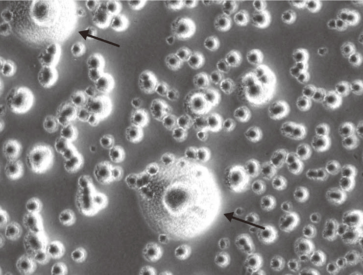支原体“现形记”：培养、指示、PCR