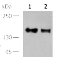 EGFR mouse monoclonal antibody