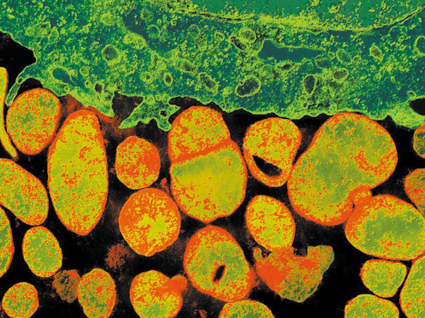 支原体“现形记”：培养、指示、PCR
