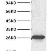 Bcl-2 mouse monoclonal antibody