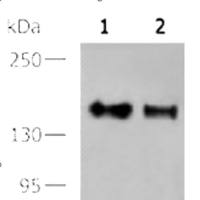 EGFR mouse monoclonal antibody