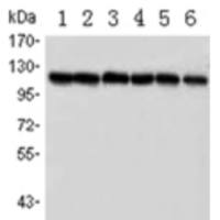 PARP mouse monoclonal antibody