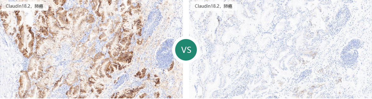 仅需12步，助你做出完美免疫组化IHC片子