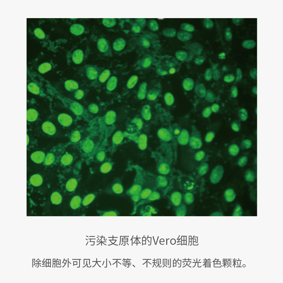 支原体“现形记”：培养、指示、PCR
