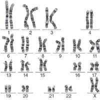 染色体核型分析