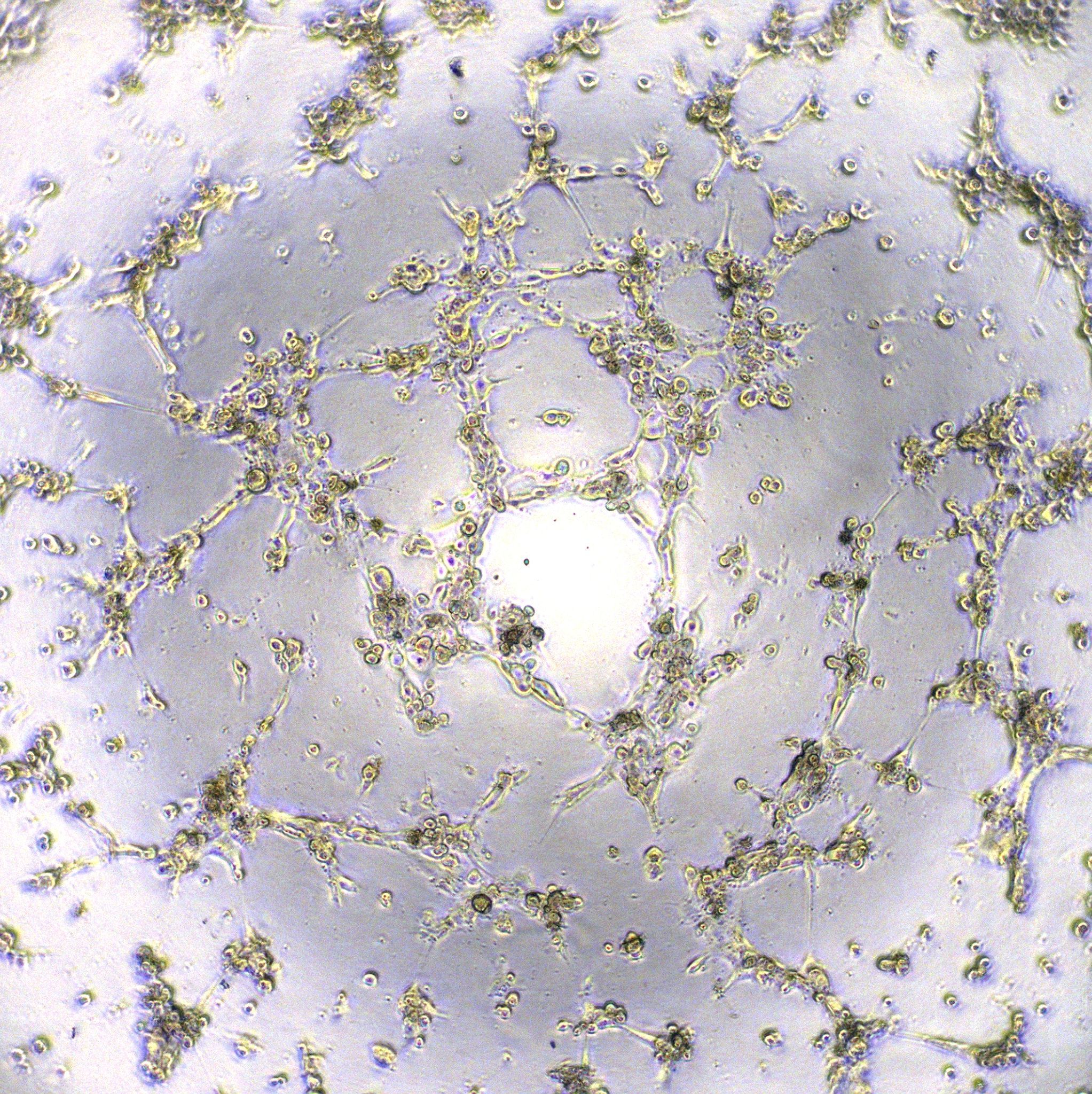 检测实验丨内皮细胞小管形成实验（Tube formation assay）