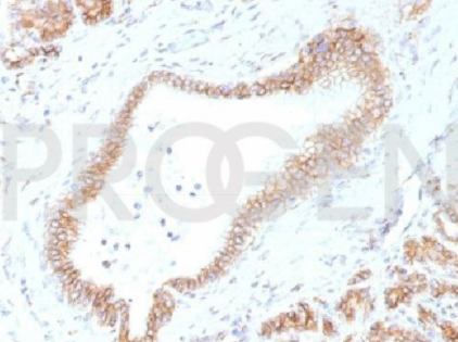 PROGEN抗p120小鼠单克隆抗体，EBS-CA-011，纯化促销