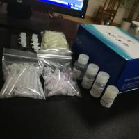 肺癌抗原Cyfra21-1特异性T细胞定量检测试剂盒